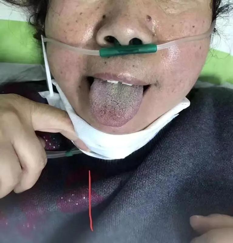 新加坡新冠肺炎最新动态更新🌟